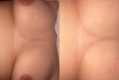 巨乳